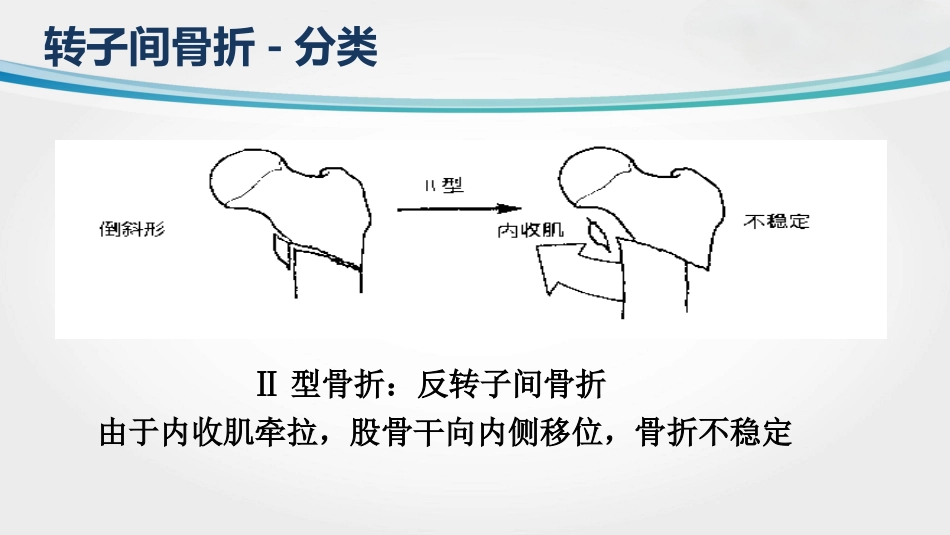 外科学：转子间骨折(2)_第7页