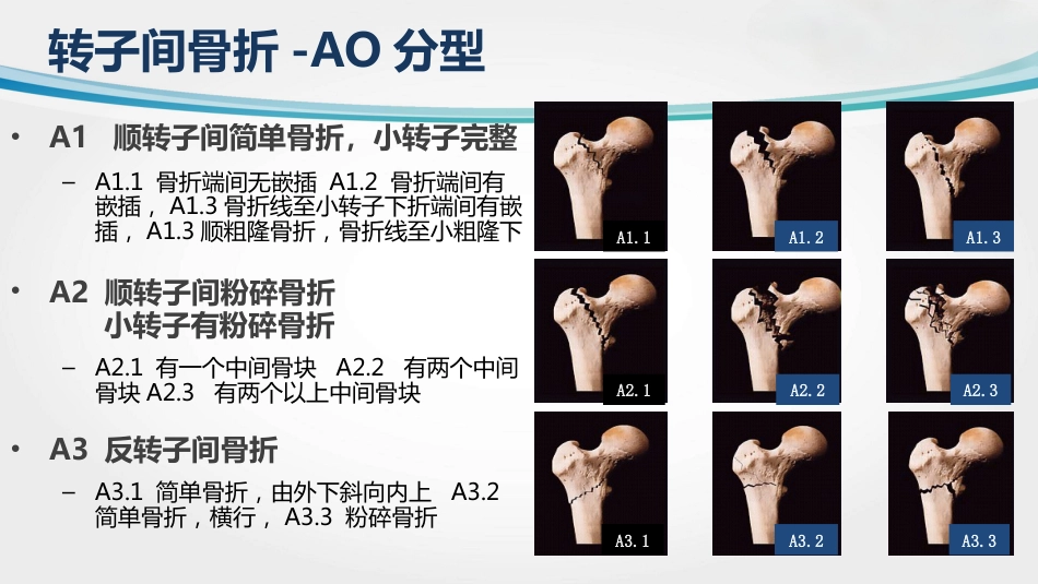 外科学：转子间骨折(2)_第8页