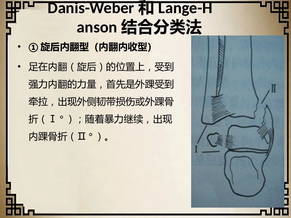 外科学：踝关节骨折的分型_第12页