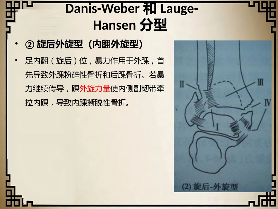 外科学：踝关节骨折的分型_第14页