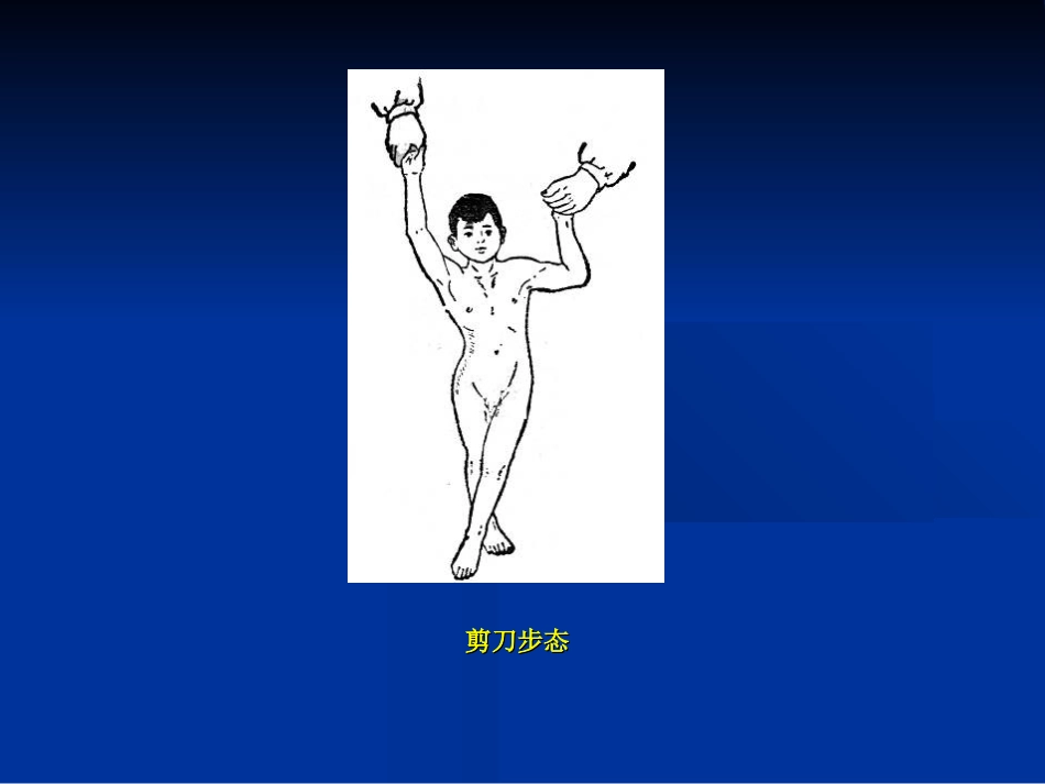 外科学：骨科体格检查_第10页