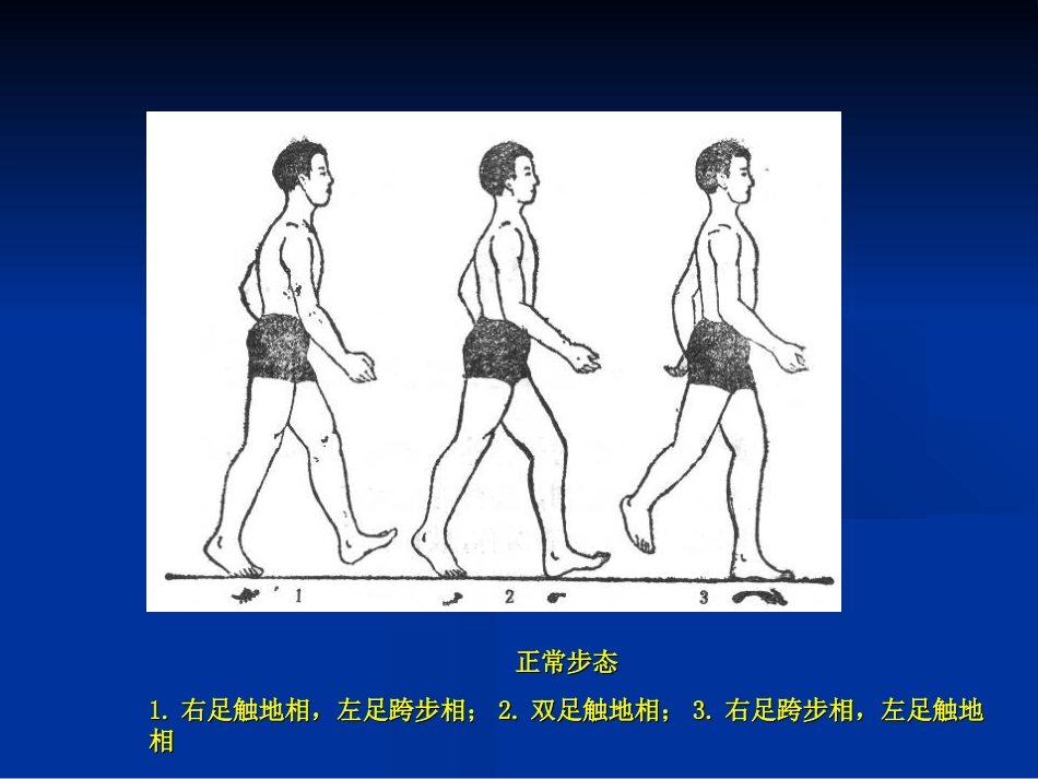 外科学：骨科体格检查_第7页