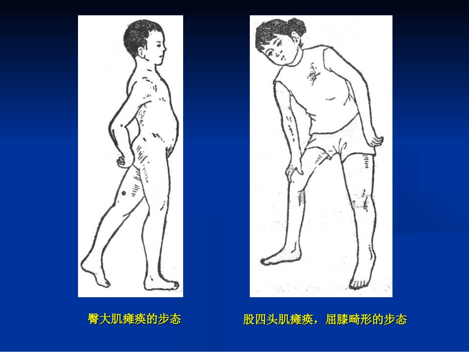 外科学：骨科体格检查_第8页