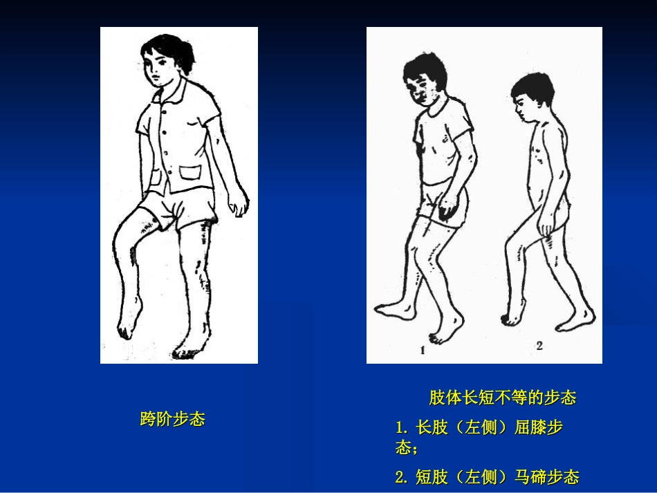 外科学：骨科体格检查_第9页