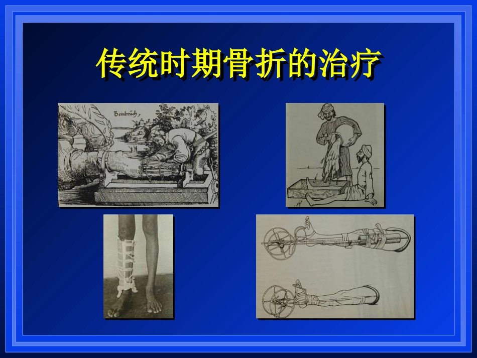 外科学：AO与BO理念_第3页
