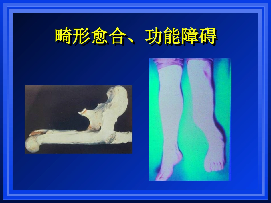 外科学：AO与BO理念_第4页