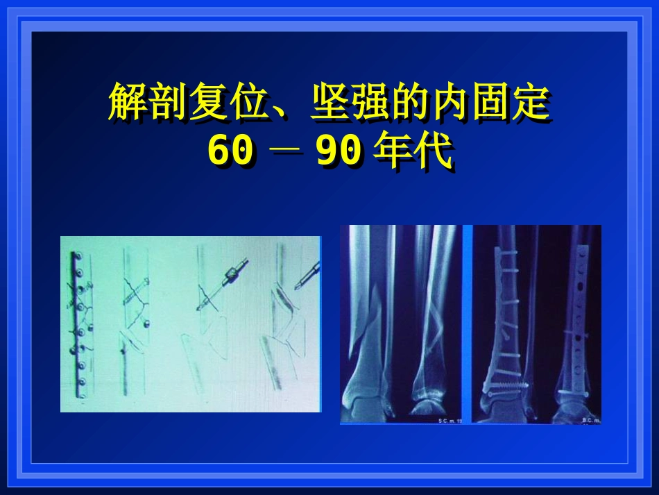 外科学：AO与BO理念_第5页