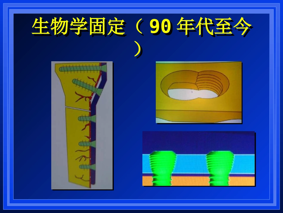 外科学：AO与BO理念_第6页