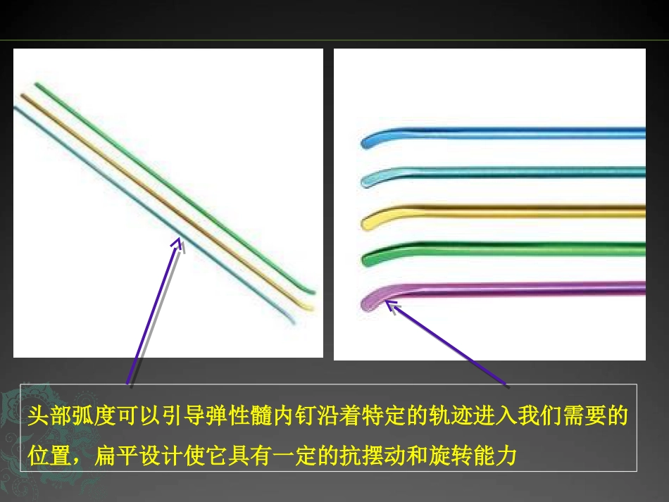 外科学：儿童长骨骨折弹性髓内钉课件_第3页