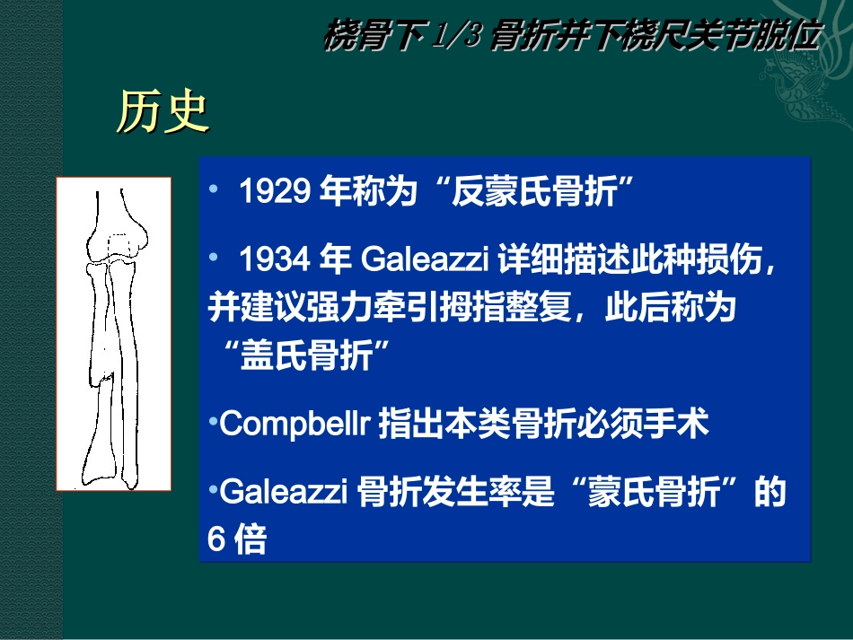 外科学：盖氏骨折_第3页