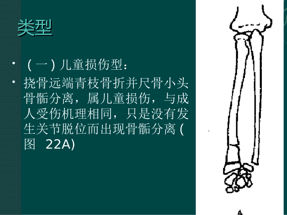 外科学：盖氏骨折_第9页