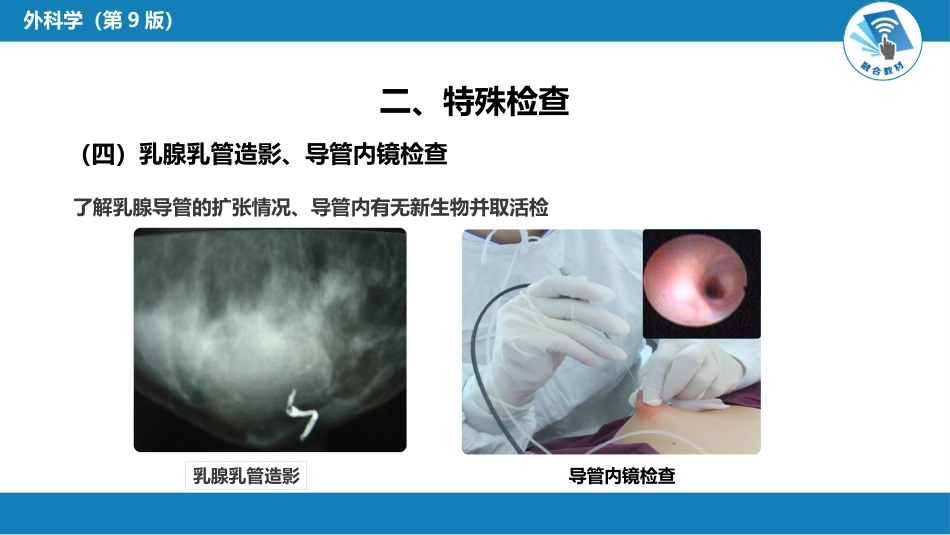 外科学：乳房疾病第一、二、三、四、五节_第15页