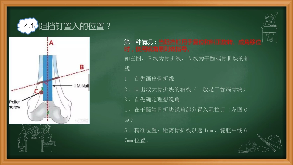 外科学：阻挡钉_第11页