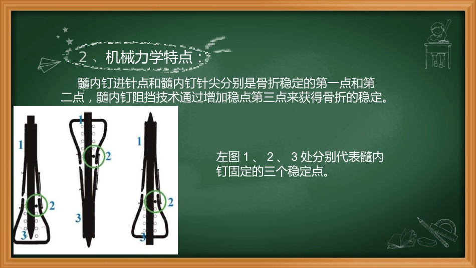 外科学：阻挡钉_第5页