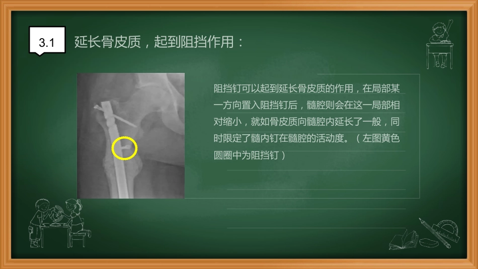 外科学：阻挡钉_第7页