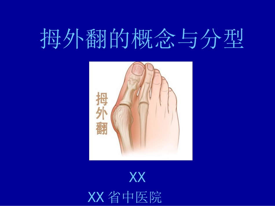 外科学：拇外翻的概念与分型_第1页