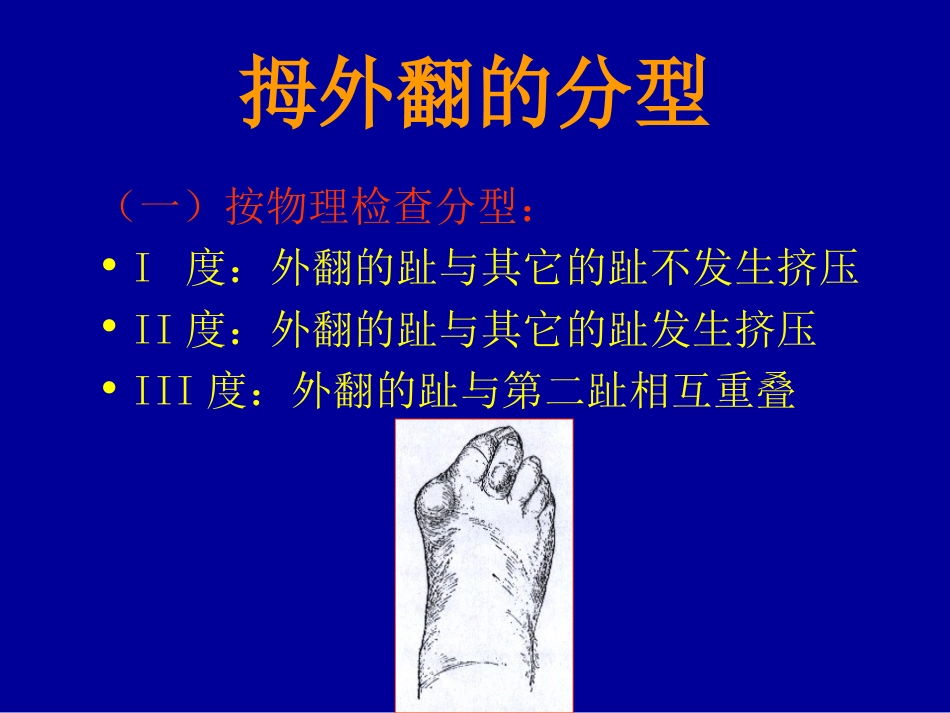 外科学：拇外翻的概念与分型_第8页