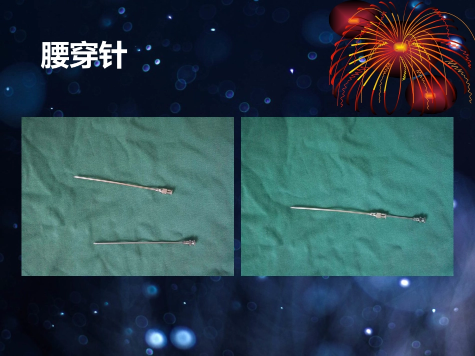 外科学：髌骨骨折的微创治疗_第11页