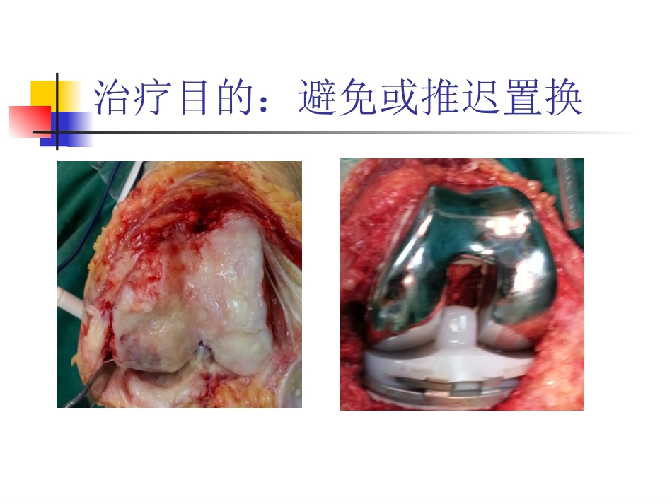 外科学：软骨修复_第10页