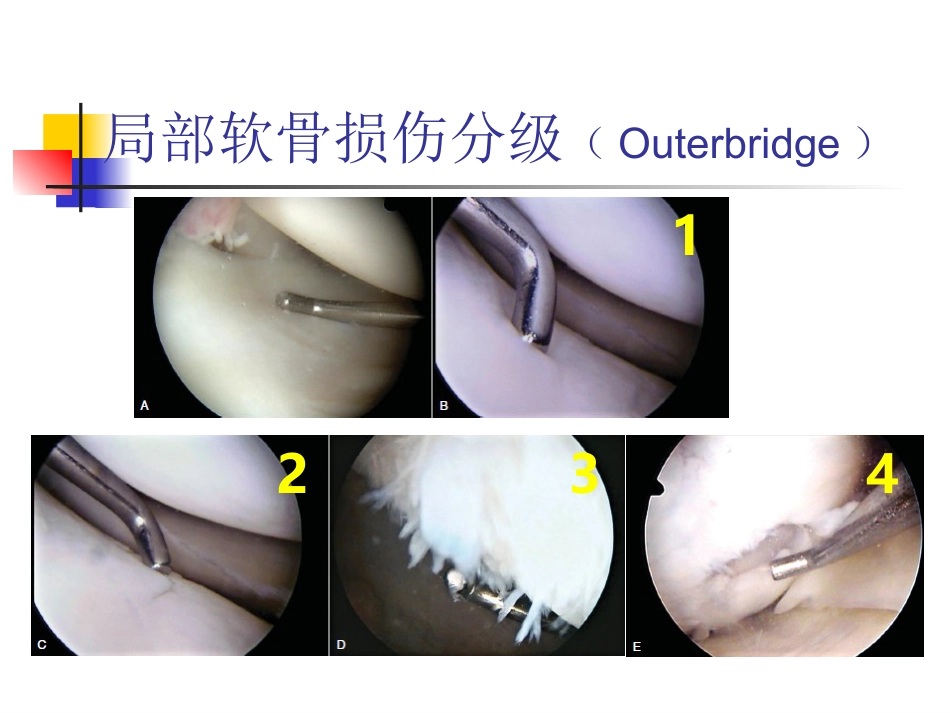 外科学：软骨修复_第11页