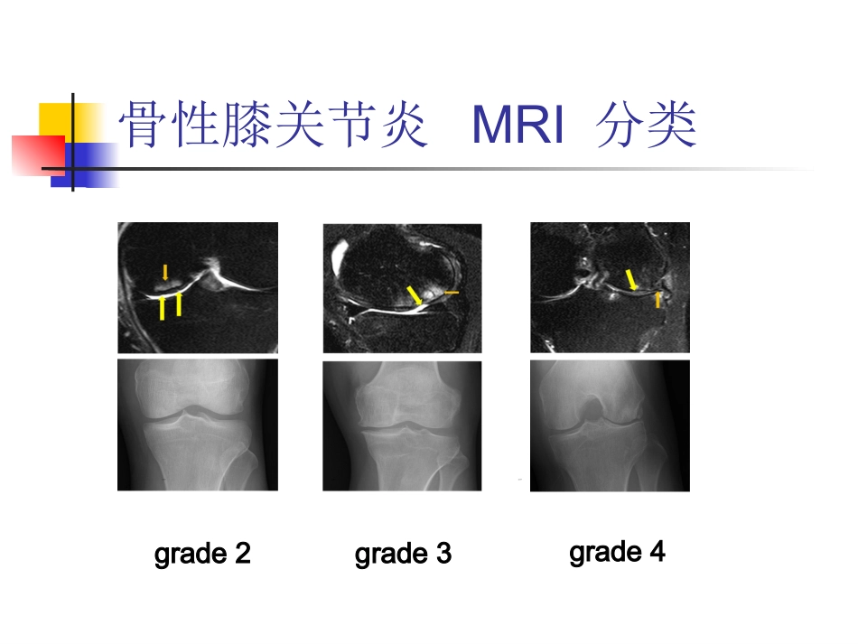 外科学：软骨修复_第15页