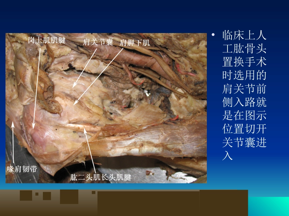 外科学：骨科解剖及手术切口入路_第10页