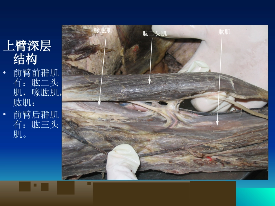 外科学：骨科解剖及手术切口入路_第13页