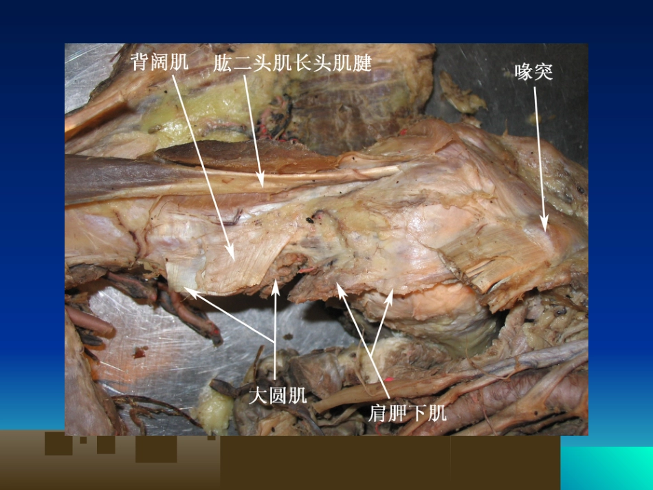 外科学：骨科解剖及手术切口入路_第6页