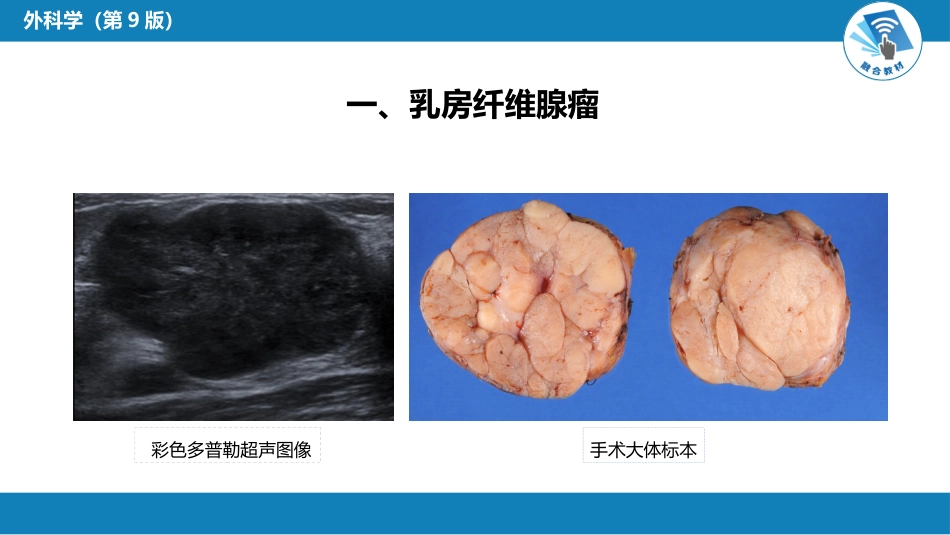外科学：乳房疾病第六节乳房肿瘤_第7页