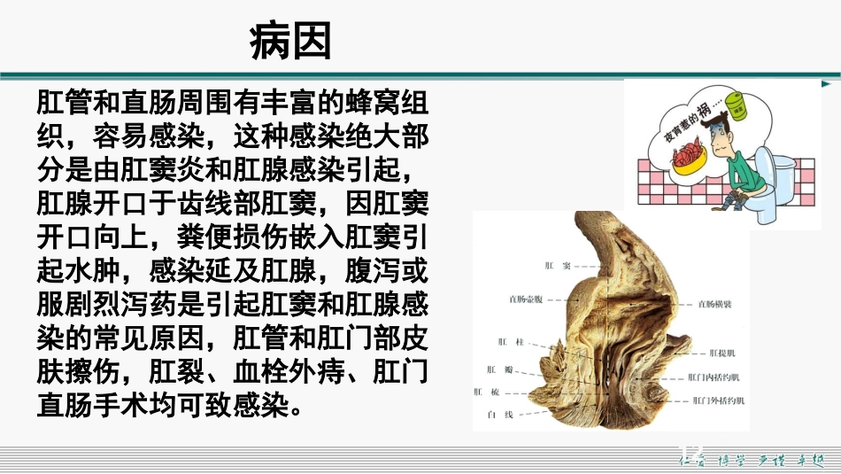 肛周脓肿和肛瘘超声诊断的临床思维_第12页
