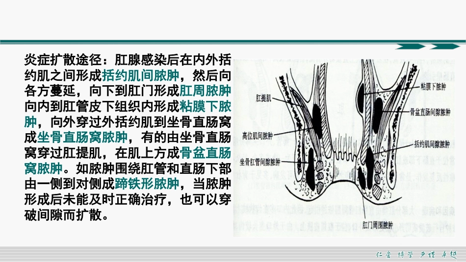 肛周脓肿和肛瘘超声诊断的临床思维_第13页