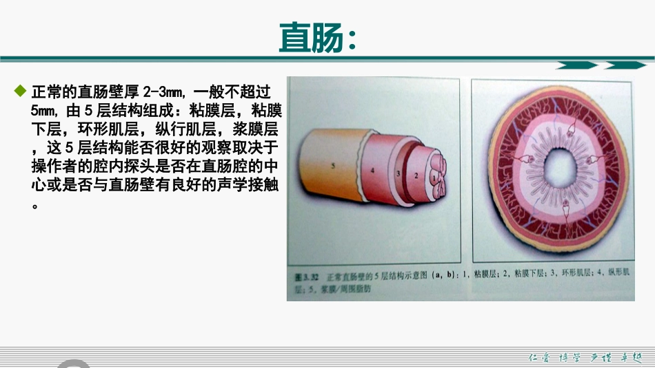 肛周脓肿和肛瘘超声诊断的临床思维_第5页