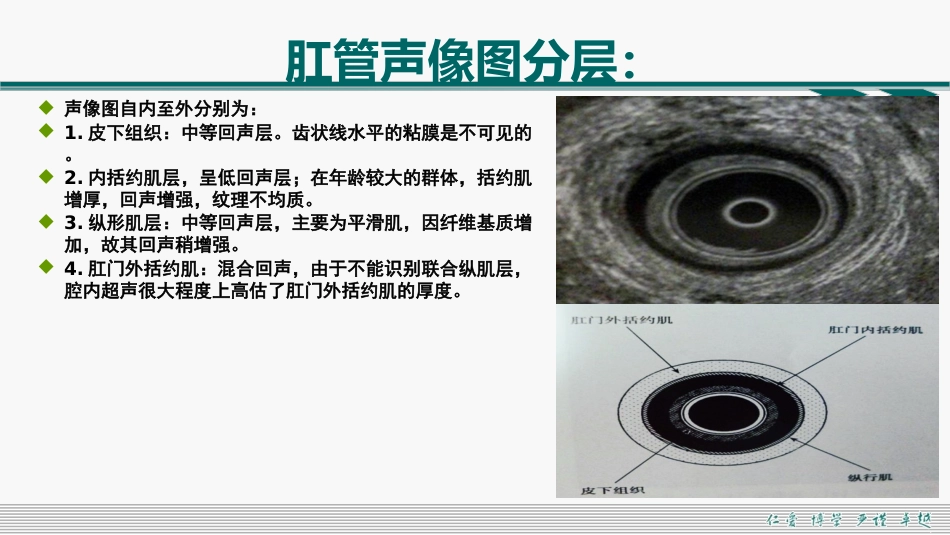 肛周脓肿和肛瘘超声诊断的临床思维_第8页