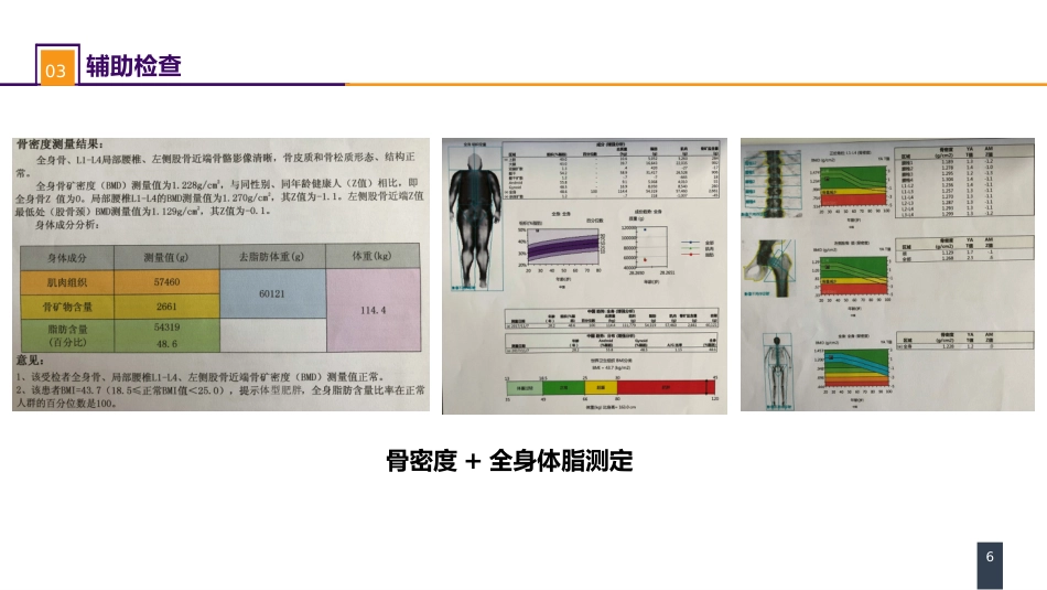 外科学： 案例分析-肥胖症_第6页