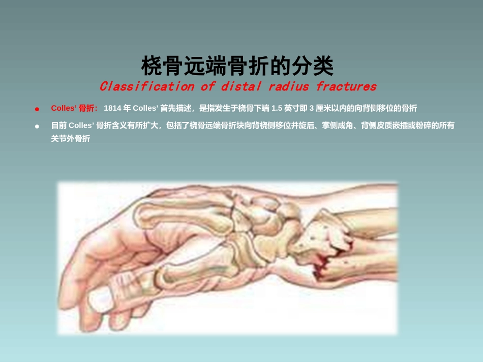 外科学：桡骨远端骨折的治疗_第11页