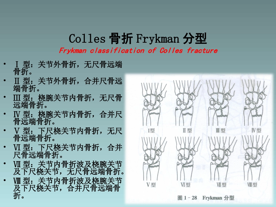 外科学：桡骨远端骨折的治疗_第12页