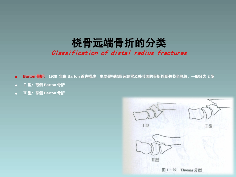 外科学：桡骨远端骨折的治疗_第14页