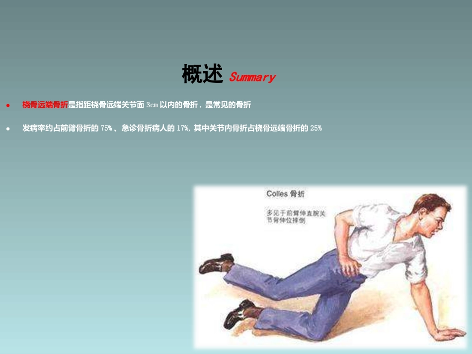 外科学：桡骨远端骨折的治疗_第2页