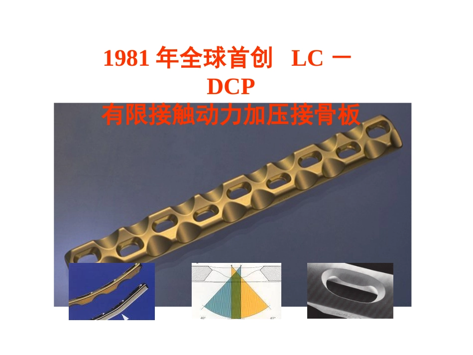 外科学：骨折内固定方案及选择原则_第15页