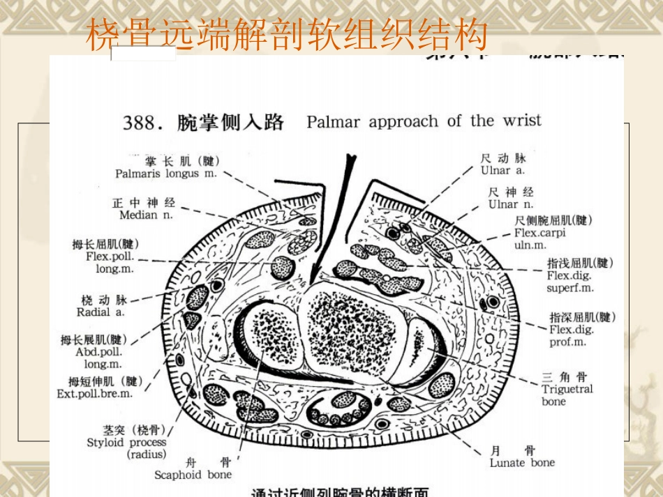 外科学：桡骨远端骨折_第12页