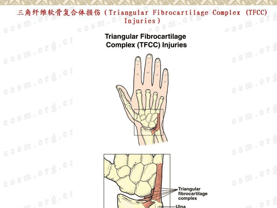外科学：桡骨远端骨折_第14页
