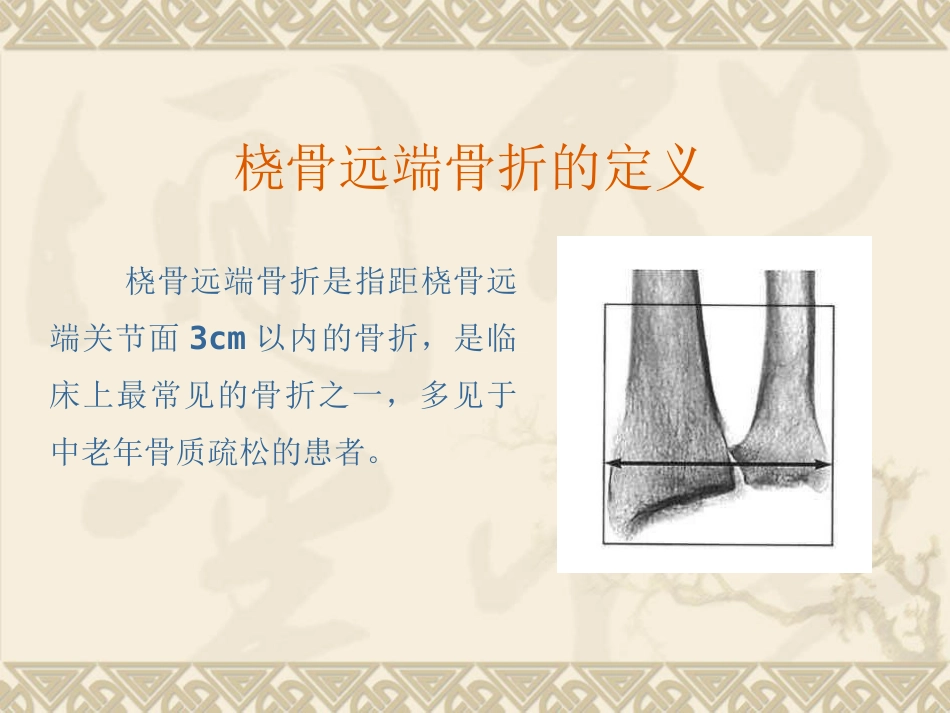 外科学：桡骨远端骨折_第2页