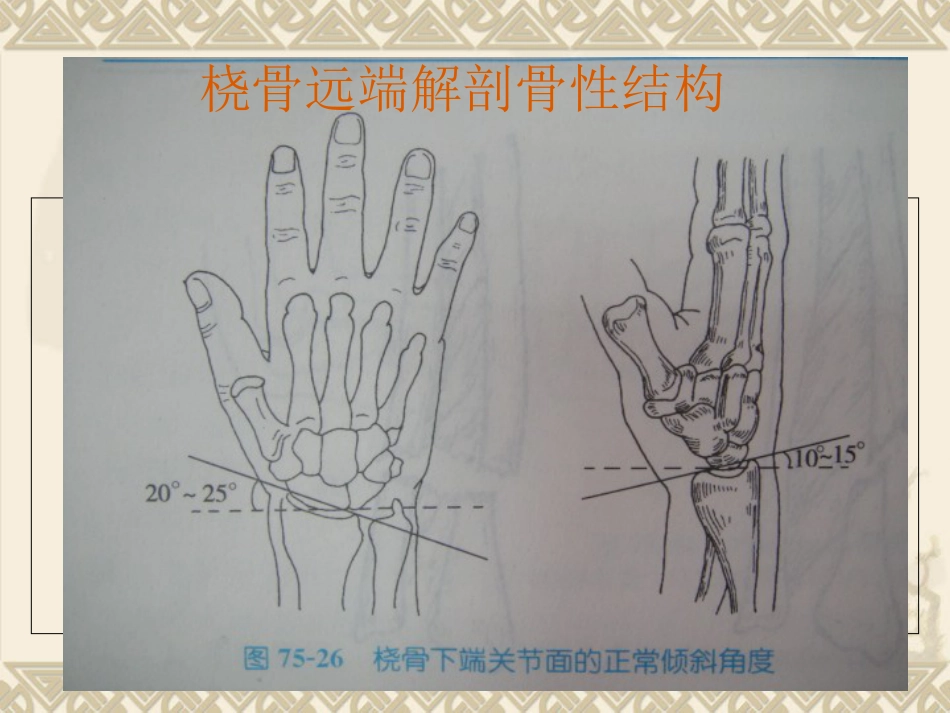 外科学：桡骨远端骨折_第8页