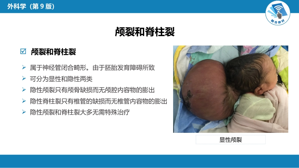 外科学：颅脑和脊髓先天畸形_第12页
