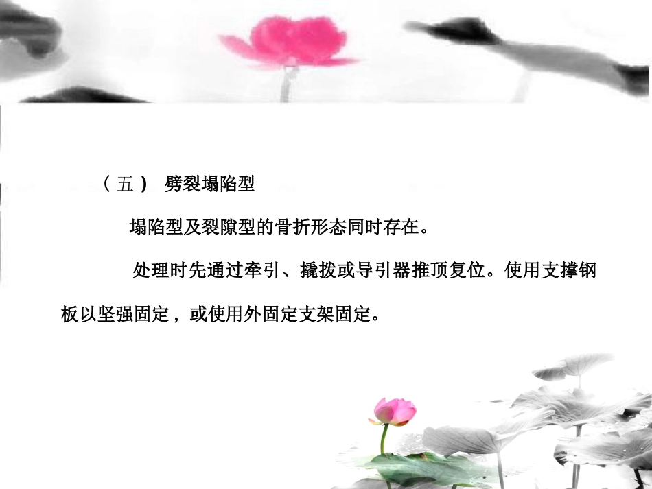 外科学：胫骨平台骨折治疗分型_第13页