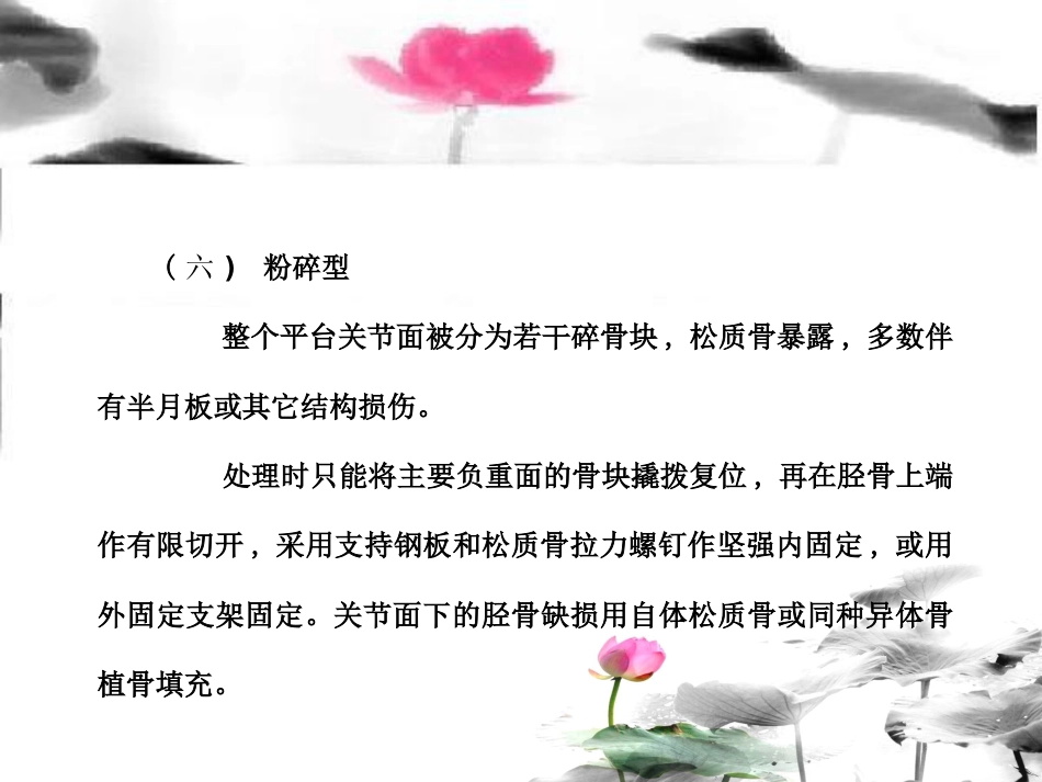 外科学：胫骨平台骨折治疗分型_第14页