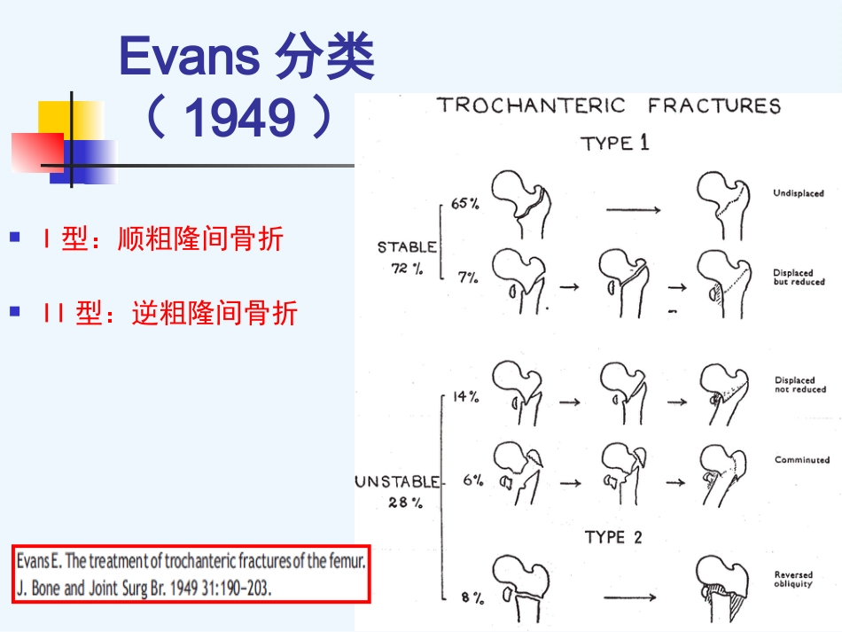 外科学：股骨粗隆间骨折内固定_第10页