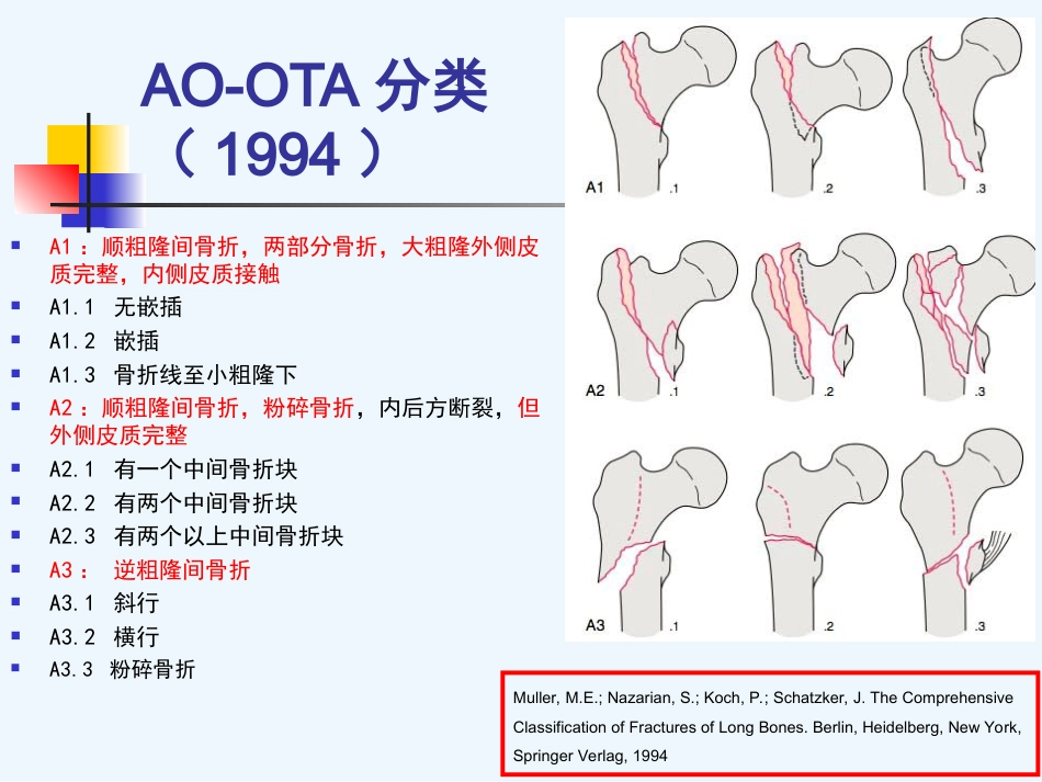 外科学：股骨粗隆间骨折内固定_第12页