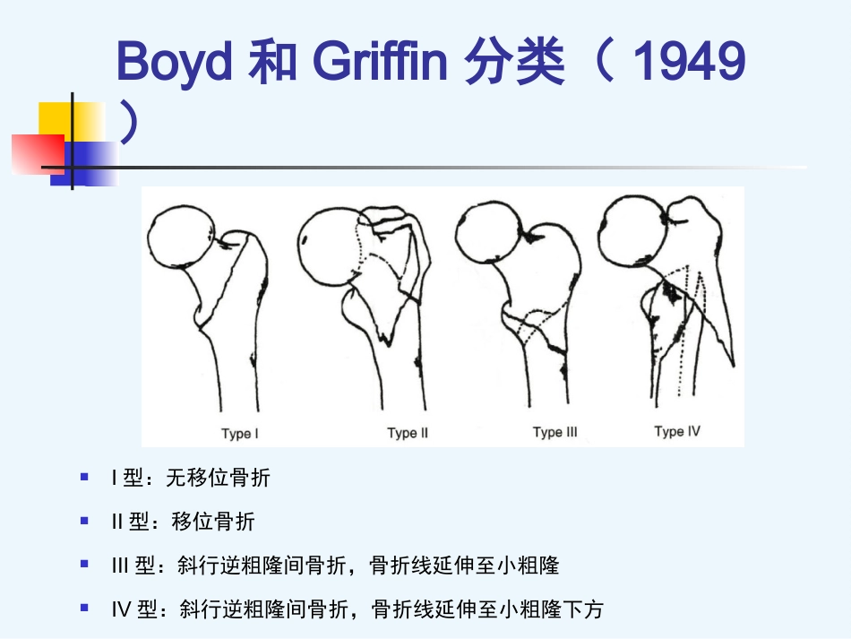 外科学：股骨粗隆间骨折内固定_第9页
