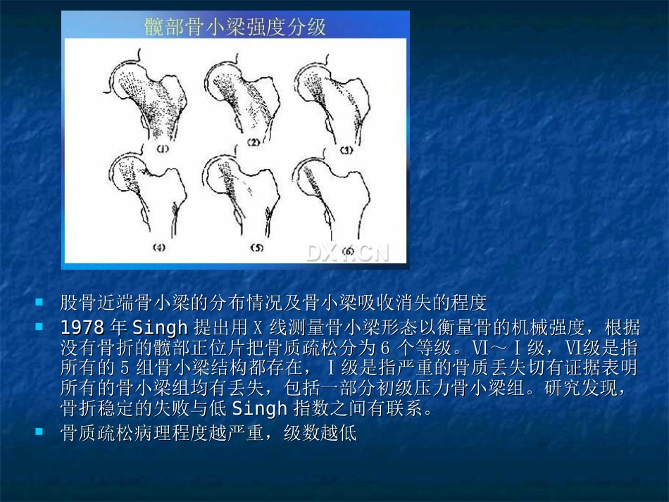 外科学：股骨转子间骨折的分型、治疗_第6页